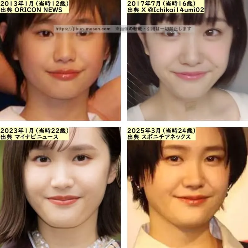 尾碕真花の唇の整形検証2013年～2025年