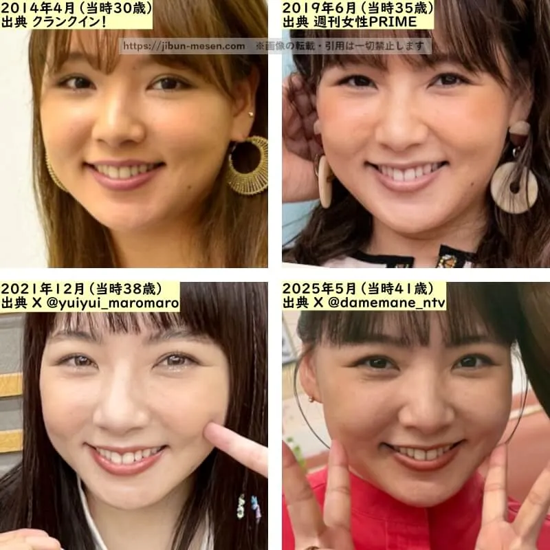 野呂佳代の鼻の整形検証2014年～2025年