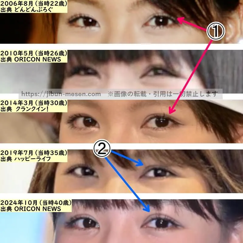 野呂佳代の目の整形検証2006年~2024年(拡大)