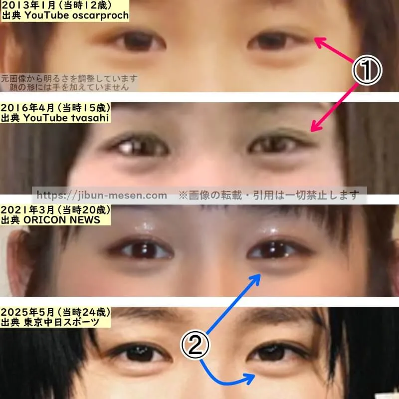 尾碕真花の目の整形検証2013年～2025年（拡大）