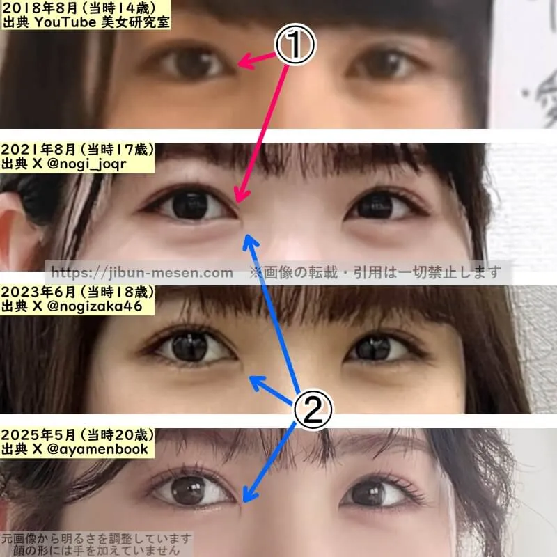 筒井あやめの目の整形検証2018年〜2025年（拡大）