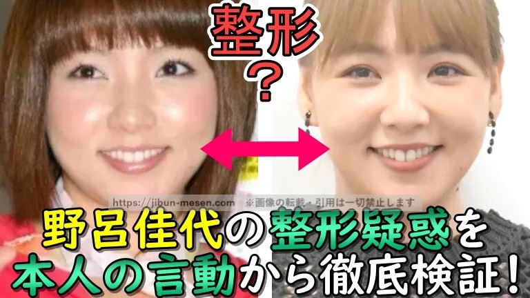 野呂佳代の二重は埋没？切開？整形疑惑をデビュー当時から2025年現在までの顔写真と本人の言動から検証！
