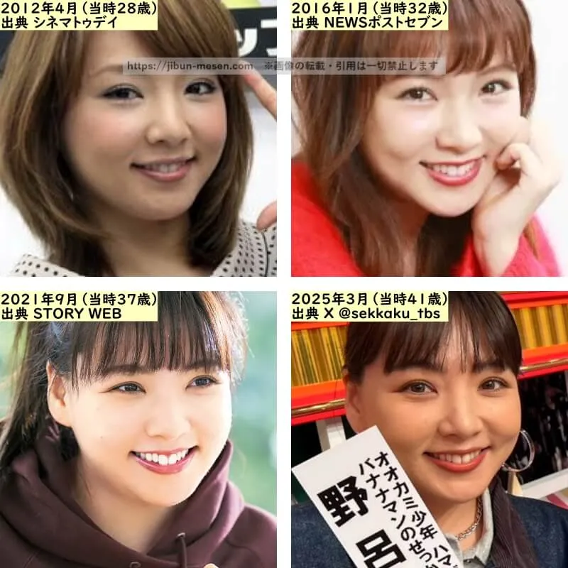 野呂佳代の唇の整形検証2012年～2025年