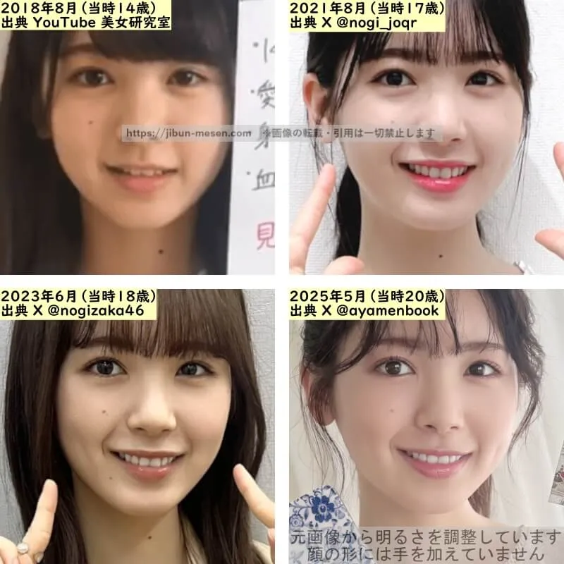 筒井あやめの目の整形検証2018年〜2025年