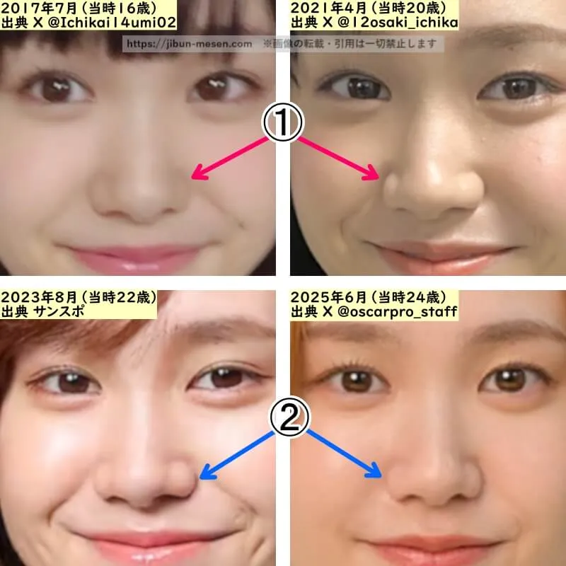 尾碕真花の鼻の整形検証2017年～2025年（拡大）
