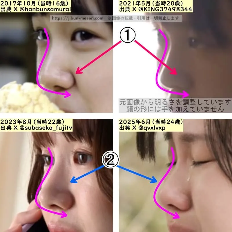尾碕真花の鼻の整形検証2017年～2025年（横顔・拡大）