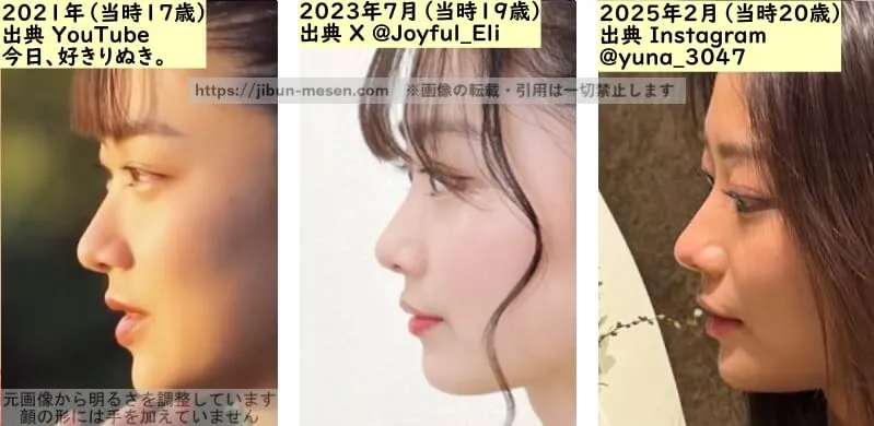 水戸由菜の鼻の整形検証2021年~2025年(横顔)