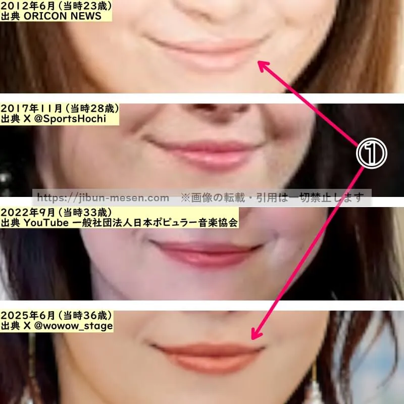 宮澤エマの唇の整形検証2012年～2025年（拡大）