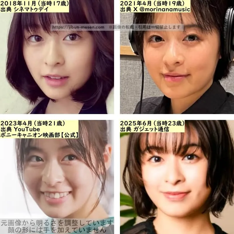 森七菜の鼻の整形検証2018年～2025年