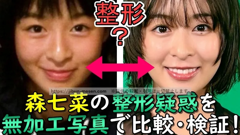 森七菜に整形疑惑が出てしまう2つの理由とは？顔が変わっているという噂を過去画像で徹底検証！