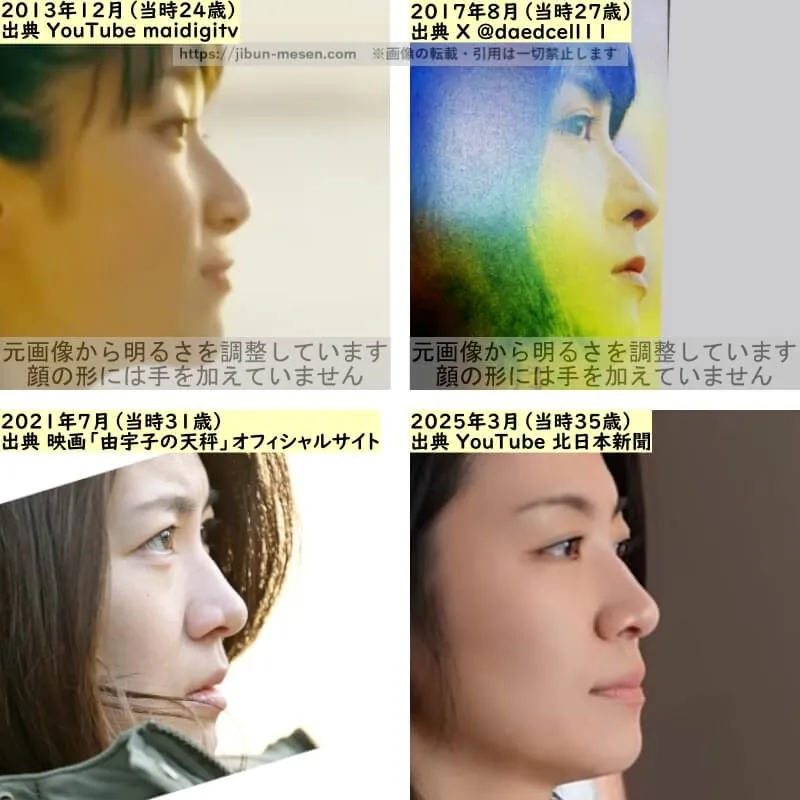 瀧内公美の鼻の整形検証2013年～2025年（横顔）