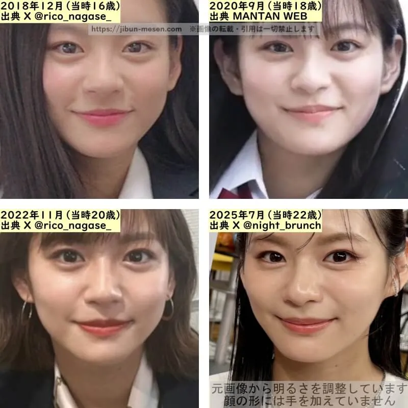 永瀬莉子の鼻の整形検証2018年～2025年