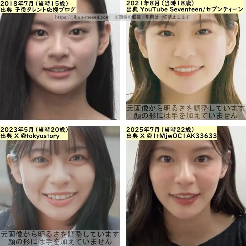 永瀬莉子の目の整形検証2018年～2025年