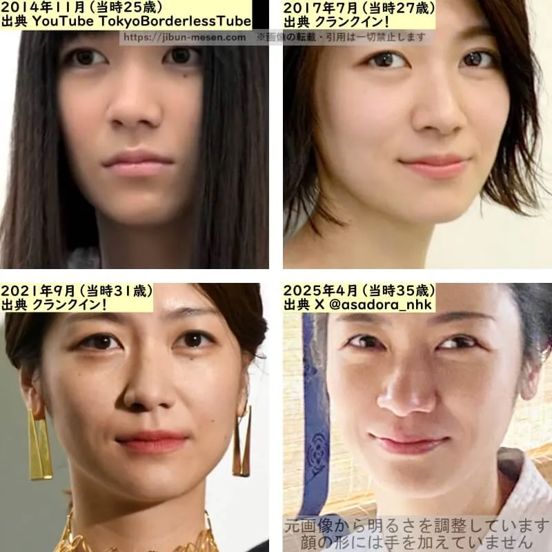 瀧内公美の鼻の整形検証2014年～2025年