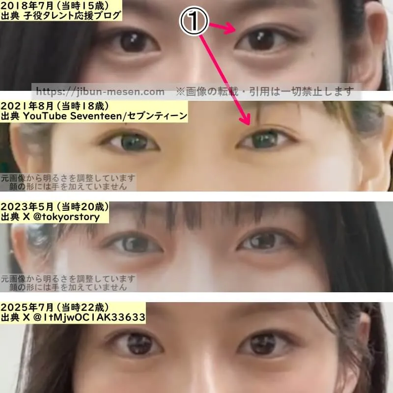 永瀬莉子の目の整形検証2018年～2025年（拡大）