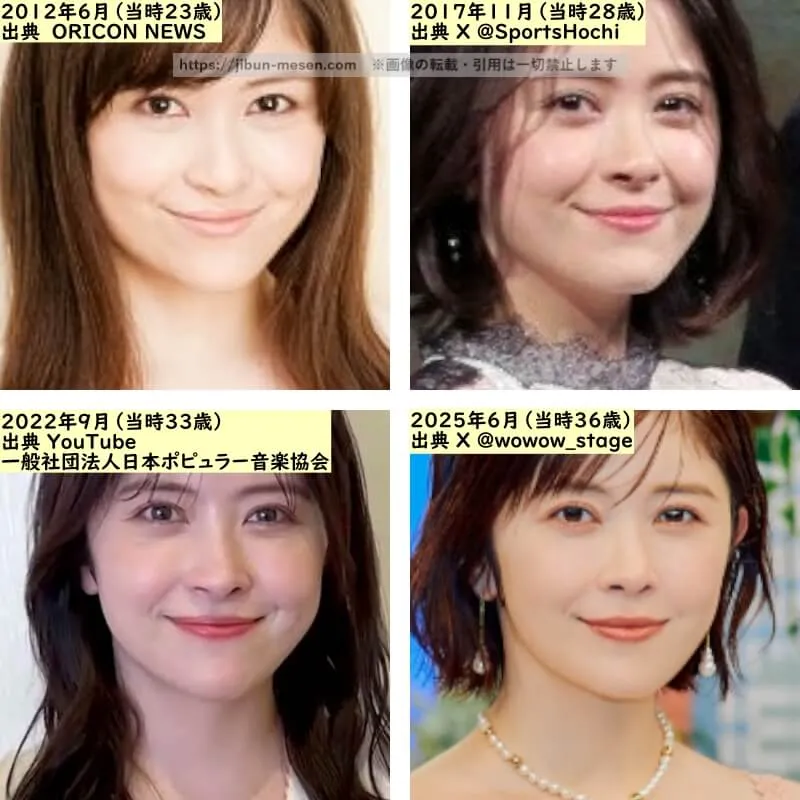 宮澤エマの唇の整形検証2012年～2025年