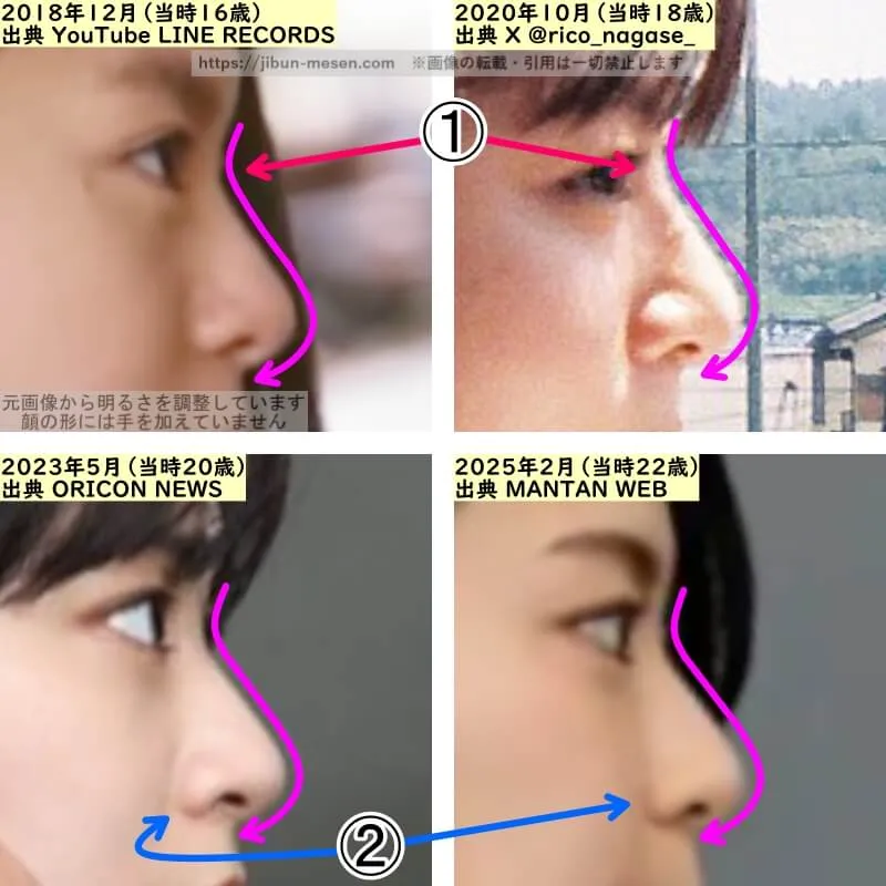 永瀬莉子の鼻の整形検証2018年～2025年（横顔・拡大）