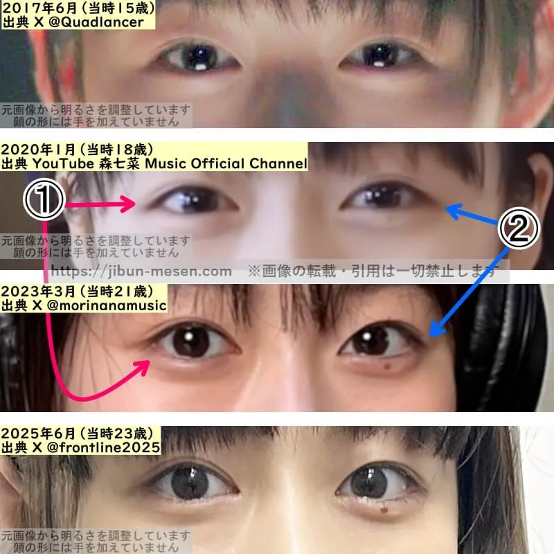 森七菜の目の整形検証2017年～2025年（拡大）
