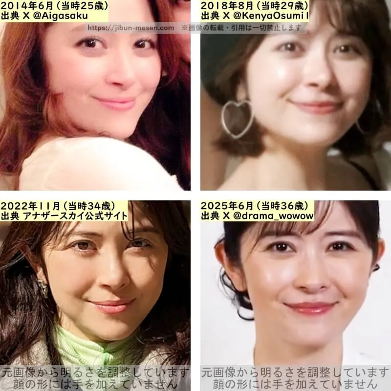 宮澤エマの鼻の整形検証2014年～2025年