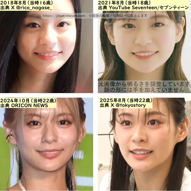 永瀬莉子の唇の整形検証2018年～2025年