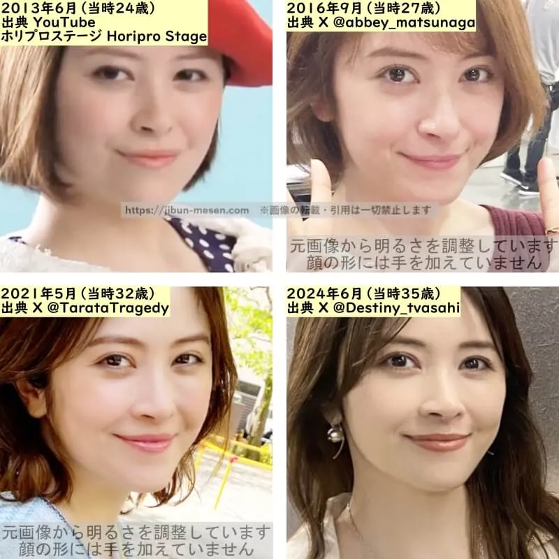 宮澤エマの目の整形検証2013年～2024年