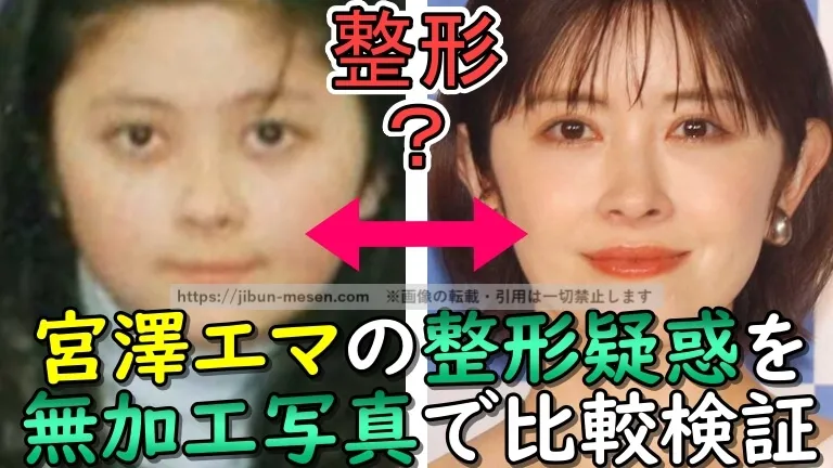 宮澤エマの整形説を完全否定！顔が変わったのは痩せたから!?2025年現在までの顔写真で比較・検証してみた！