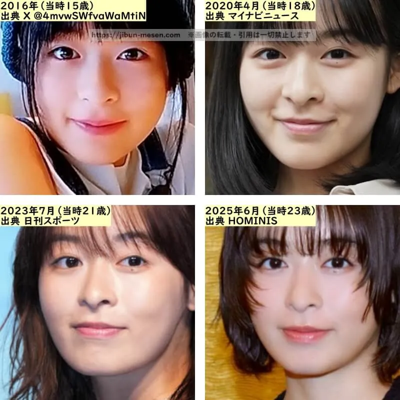 森七菜の唇の整形検証2016年～2025年