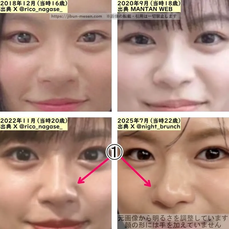 永瀬莉子の鼻の整形検証2018年～2025年（拡大）