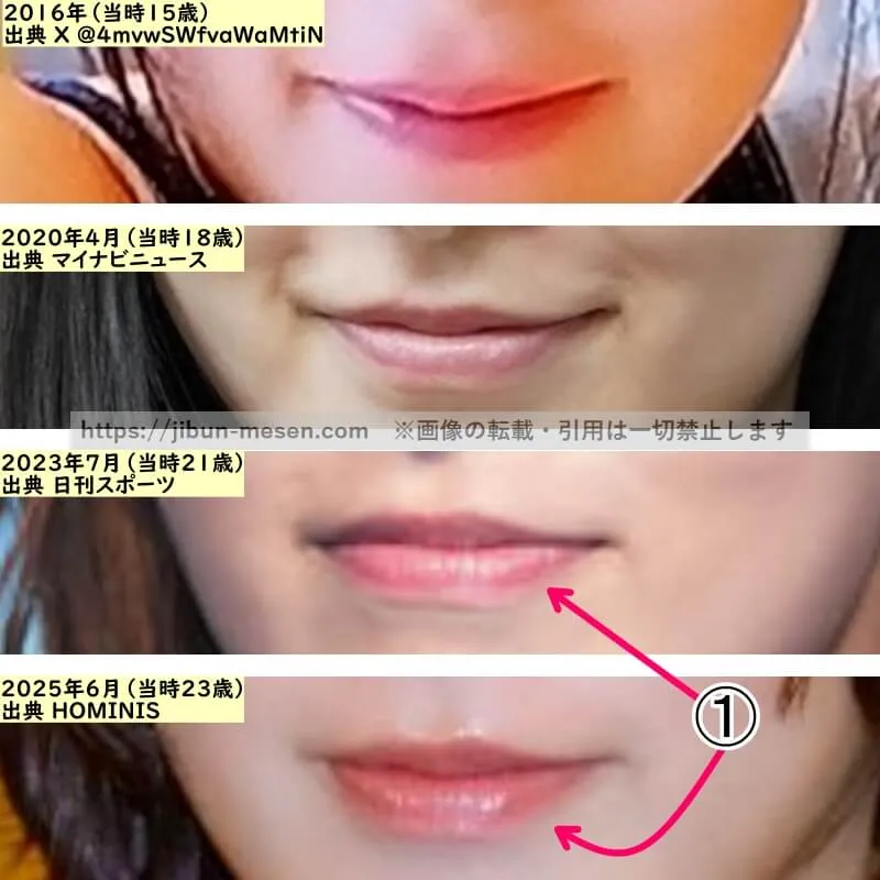 森七菜の唇の整形検証2016年～2025年（拡大）
