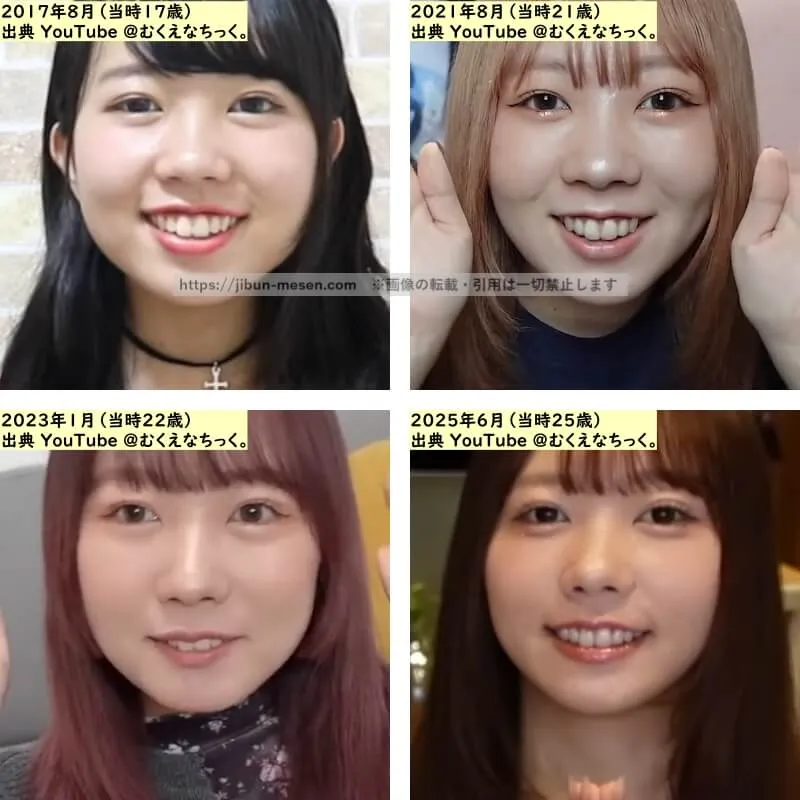 むくえな むくの目の整形検証2017年～2025年