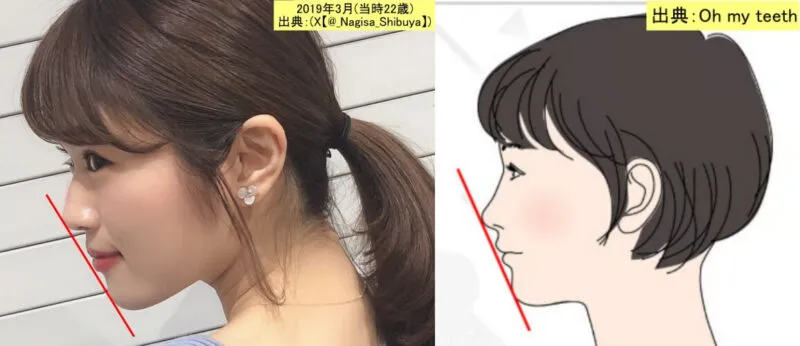 渋谷凪咲の横顔【左】と普通の東洋人の女性の横顔のイラスト【右】