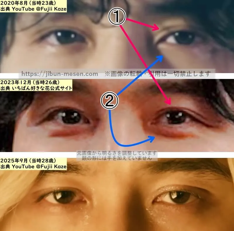 藤井風の目の整形検証2020年～2025年（拡大）の画像