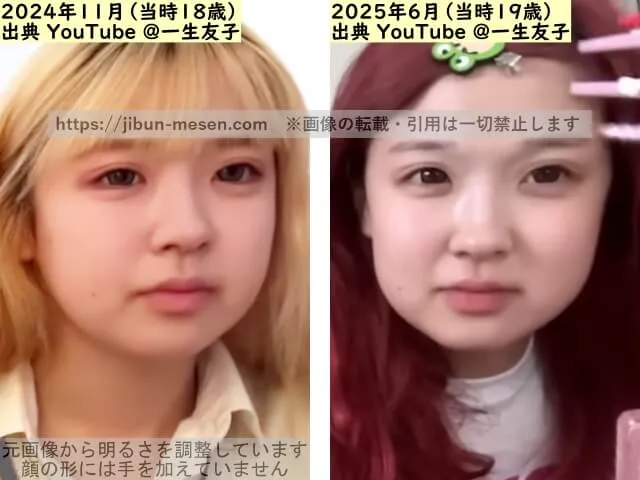 一生友子ユナの唇の整形検証2024年～2025年