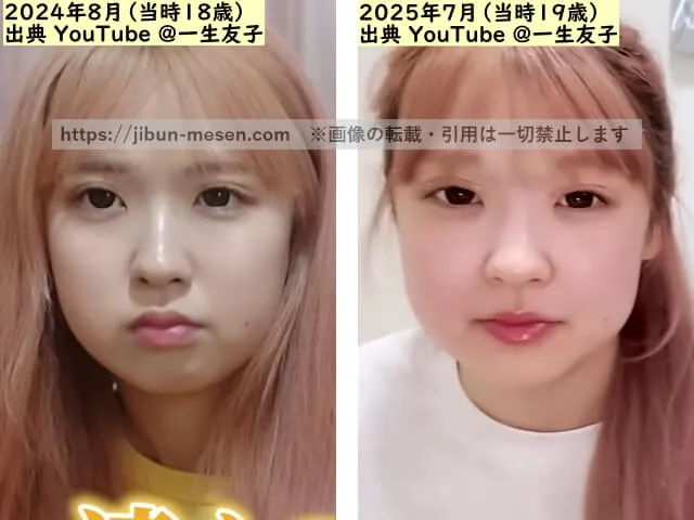一生友子ユナの鼻の整形検証2024年～2025年