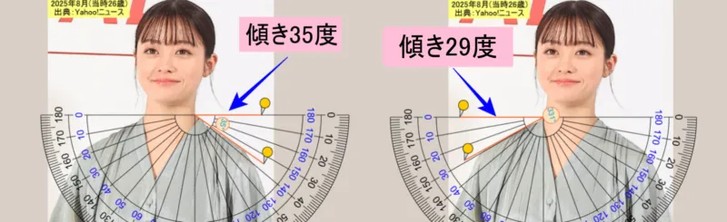 橋本環奈の水平線からの両肩の傾きの角度(左の写真は左肩、右の写真は右肩) 出典Yahoo!ニュース