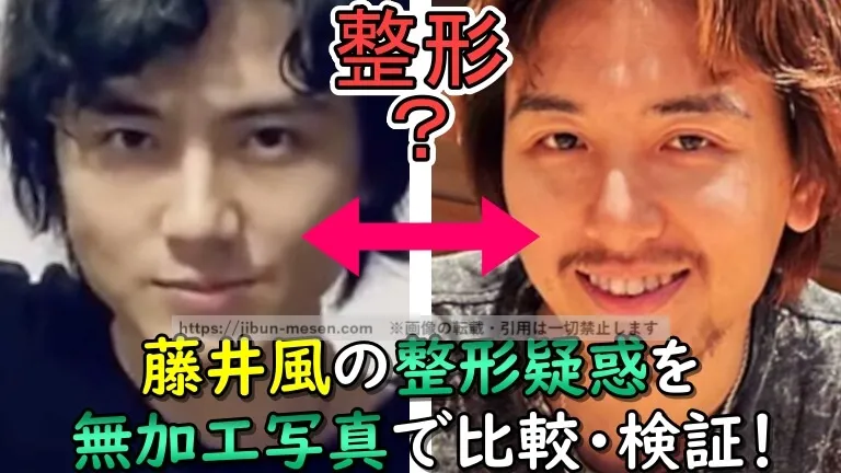 藤井風に整形疑惑!?顔が変わった理由は歯並びの影響？デビュー当時から2025年現在までの比較で変化を徹底検証！