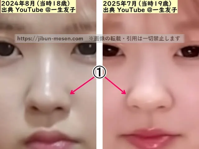 一生友子ユナの鼻の整形検証2024年～2025年（拡大）