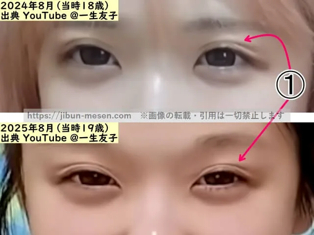 一生友子ユナの目の整形検証2024年～2025年（拡大）