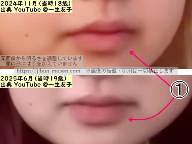 一生友子ユナの唇の整形検証2024年～2025年（拡大）