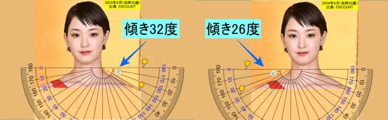剛力彩芽の水平線からの両肩の傾きの角度(左の画像は左肩、右の画像は右肩) 出典_ENCOUNT
