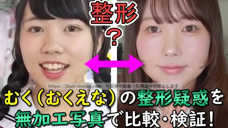むく(むくえな)の顔が変わった？本人が整形公言!?デビュー当時から2025年現在の顔写真で徹底検証！