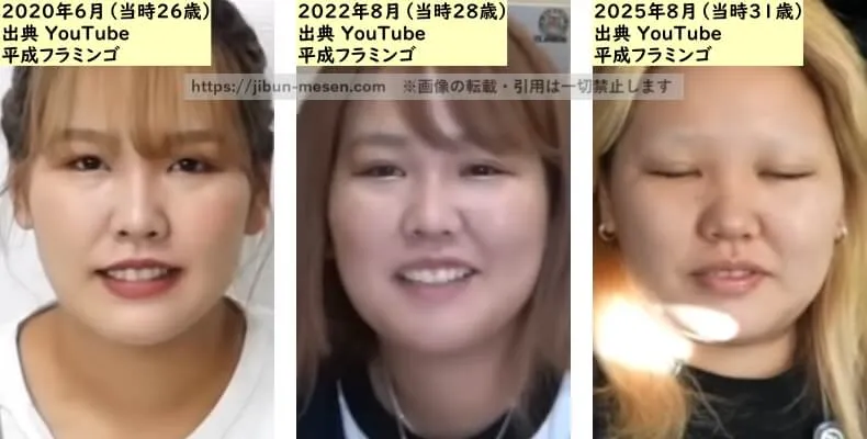 りほ（平成フラミンゴ）の鼻の整形検証2020年～2025年の画像
