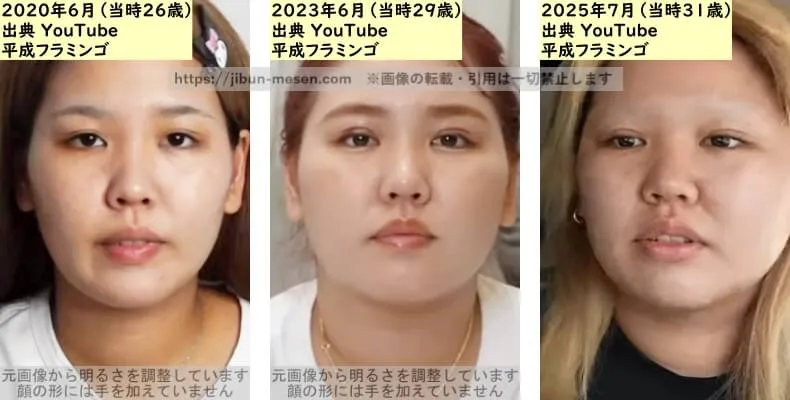 りほ（平成フラミンゴ）の目の整形検証2020年～2025年の画像