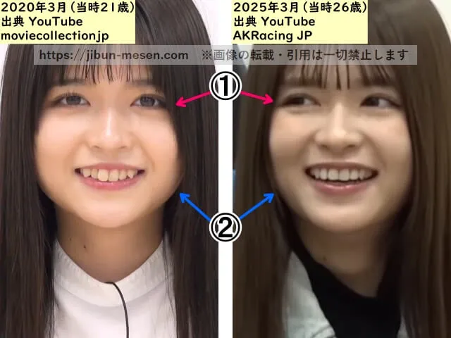 景井ひなの顔の整形検証2020年~2025年