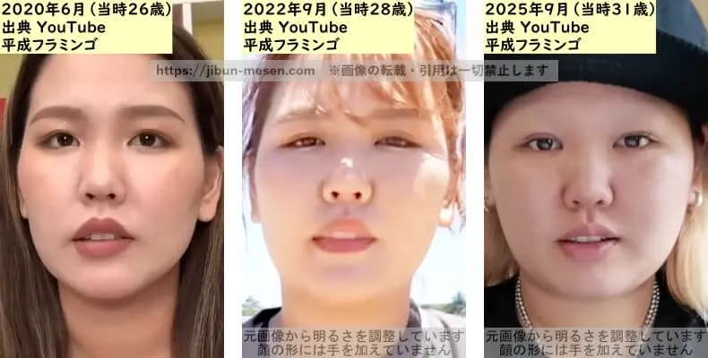 りほ（平成フラミンゴ）の唇の整形検証2020年～2025年の画像