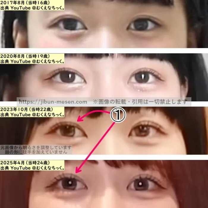 むくえな えなの目の整形検証2017年～2025年（拡大）の画像