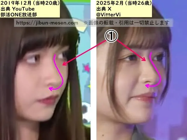 景井ひなの顔の整形検証2020年~2025年(横顔)