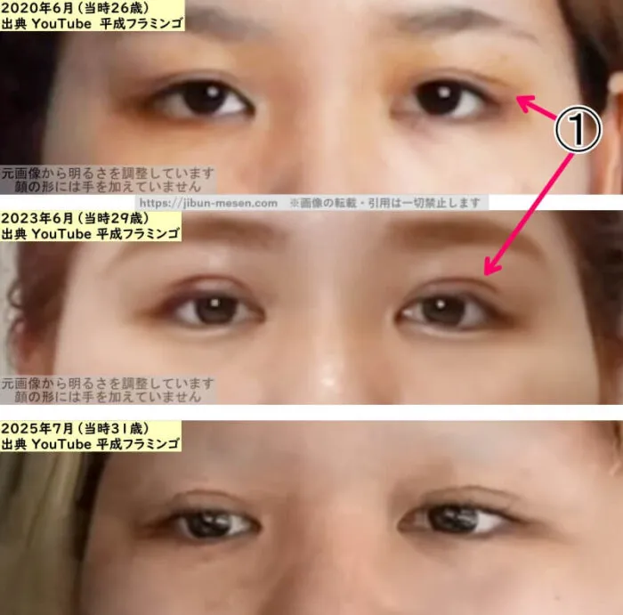 りほ（平成フラミンゴ）の目の整形検証2020年～2025年（拡大）の画像