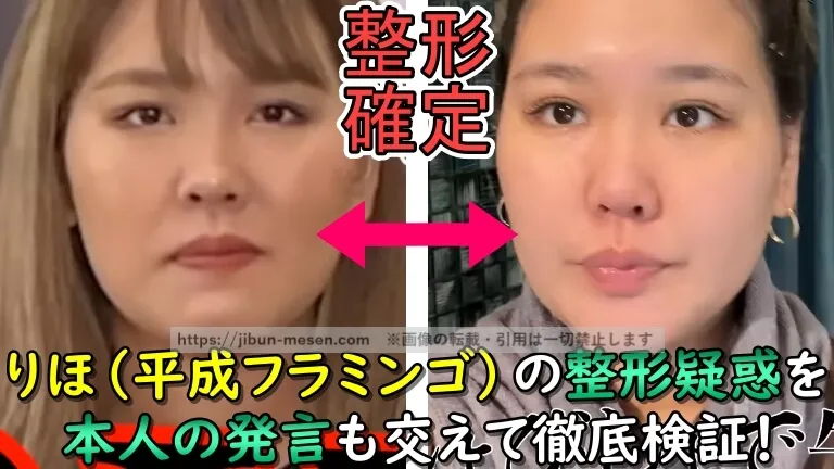 りほ(平成フラミンゴ)が整形を公表！埋没法にかけた費用は？2025年現在までの顔の変化を顔写真の比較で徹底検証！