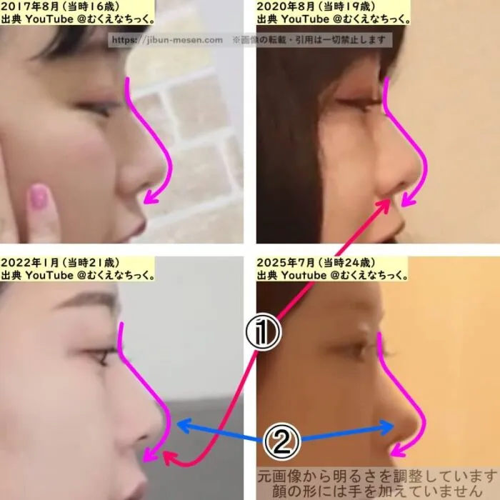むくえな えなの鼻の整形検証2017年～2025年（横顔・拡大）の画像